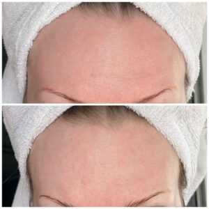 اسنس حلزون و آزولن تیام اصل کره